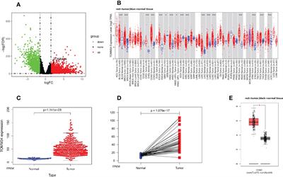 TOMM34 serves as a candidate therapeutic target associated with immune cell infiltration in colon cancer